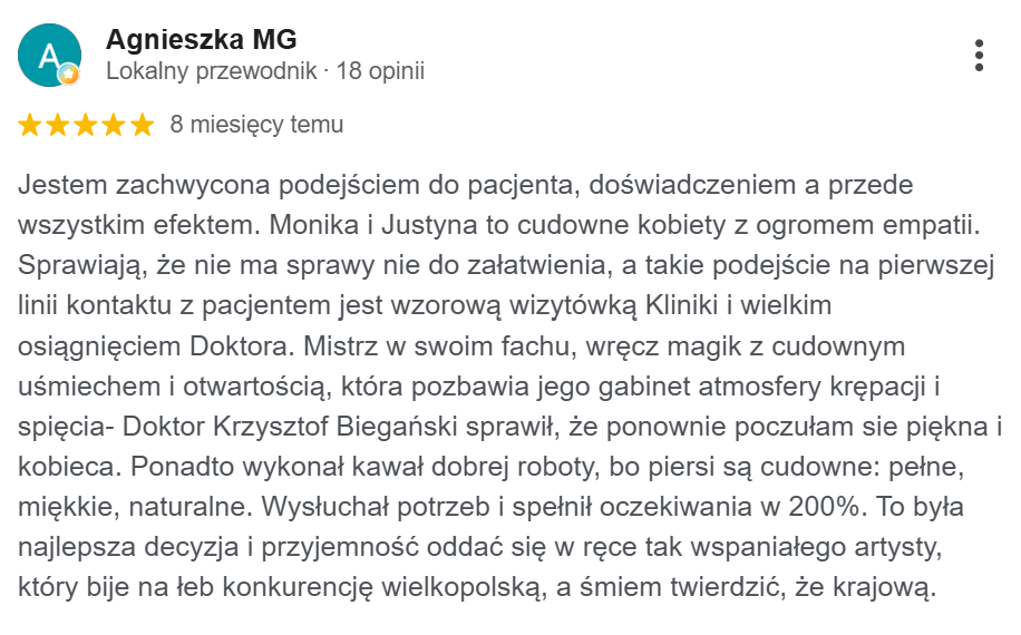 Opinia pacjenta - Google