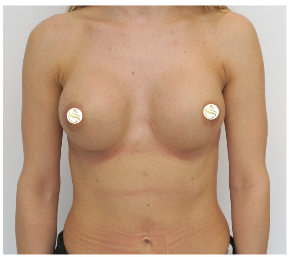 Po: Powiększanie piersi 340ml